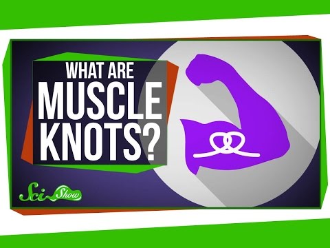 What Are Muscle Knots?