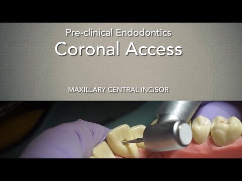 Dostęp endodontyczny - siekacz centralny szczęki