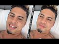 SAD AUSTIN MCBROOM FIRST WORDS AFTER KO LOSS TO ANESONGIB; SHOWS OFF BRUISES & GIVES GIB RESPECT