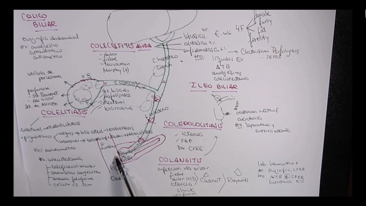 MEJOR EXPLICACIÓN COLELITIASIS, COLECISTITIS, COLEDOCOLITIASIS, COLANGITIS ...