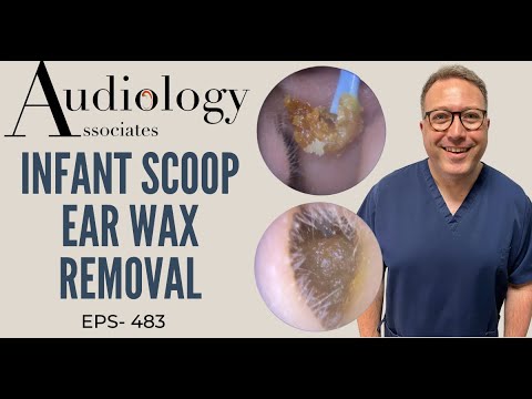 INFANT SCOOP, JOBSON HORNE & SUCTION EAR WAX REMOVAL - EP483
