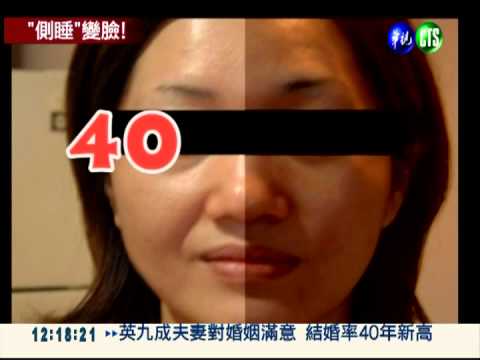 老是側睡同一邊 睡出大小臉