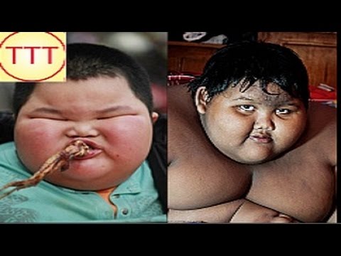Top 5 Niños mas Gordos del Mundo