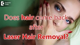 Does hair grow back after laser hair removal? - Dr. Nischal K