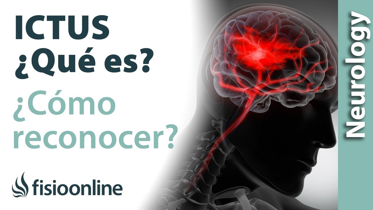 QUÉ ES un ICTUS y cómo reconocerlo para tratarlo