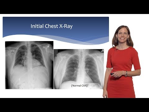 Bench to Bedside: Mesenchymal Stem Cells and ARDS, Part 1 - Carolyn Calfee