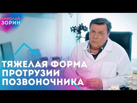 Перед овуляцией может болеть поясница Чем лечить шейный остеохондроз полезные советы