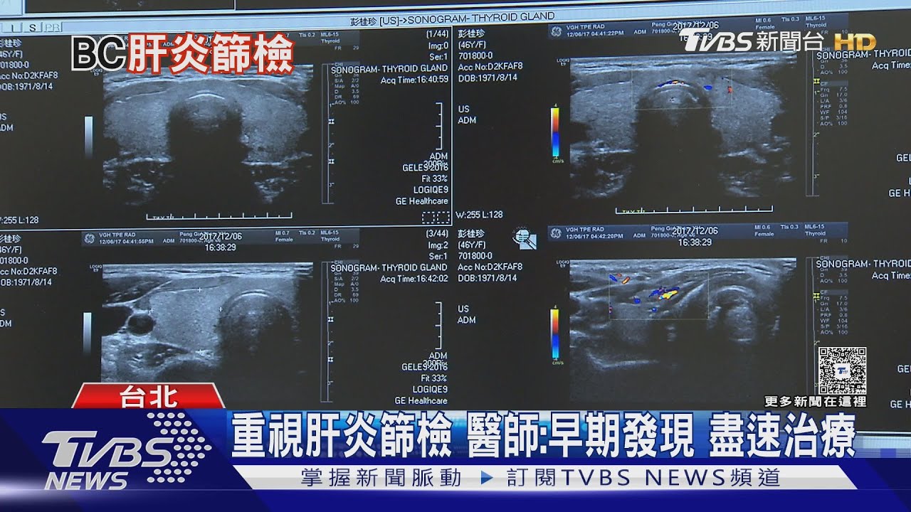 不積極做「這件事」威脅健康.... 醫師:恐一步步走向...肝癌!