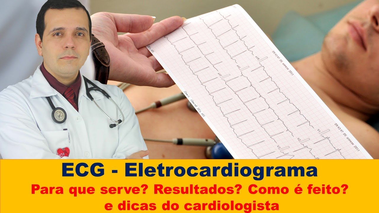 ECG: Como funciona o eletrocardiograma e o que ele revela sobre o seu coração