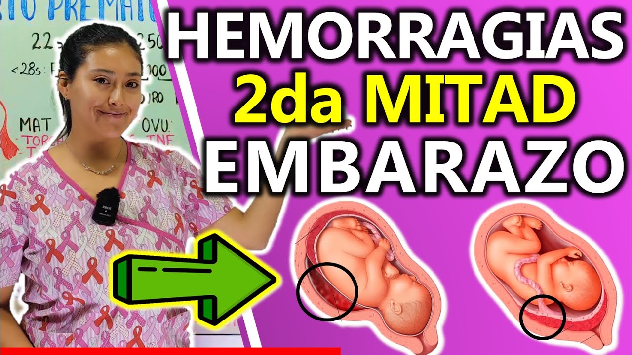HEMORRAGIAS DE LA 2DA MITAD DEL EMBARAZO (PLACENTA PREVIA Y DPPNI) | GuiaMed