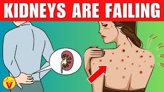 10 Warning Signs Your Kidneys Are Failing And Crying For Help | VisitJoy