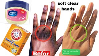 How to make your hand Soft Wrinkle-free with baking soda an vaseline get Clear younger-looking