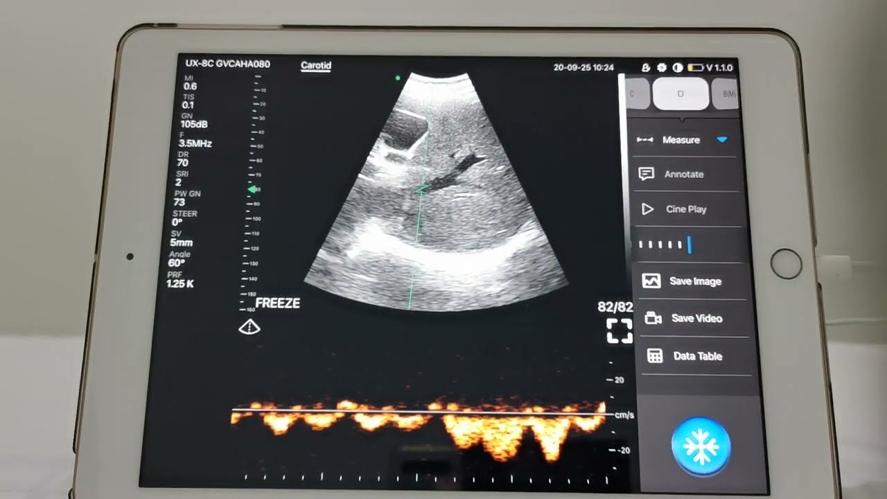 Double Handheld Color Doppler Ultrasound Probe​