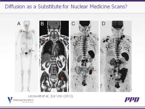 PPD & VirtualScopics: Imaging for Oncology Clinical Trials