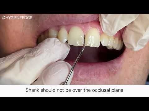 Probing do's and don'ts