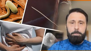 Parazitët e trupit, Altin Joka: 4 detokse efektive për eleminimin e tyre