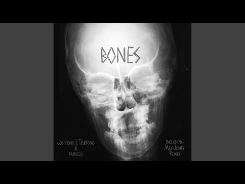 Bones