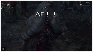 [初見実況]Blood borne#14[禁域の森#3]