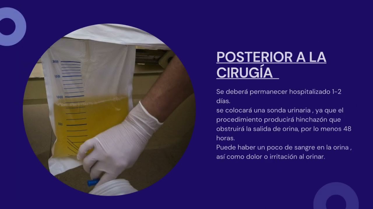 Irving Reyna Blanco-17