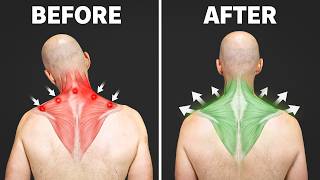90% of Neck Tightness Comes from THIS