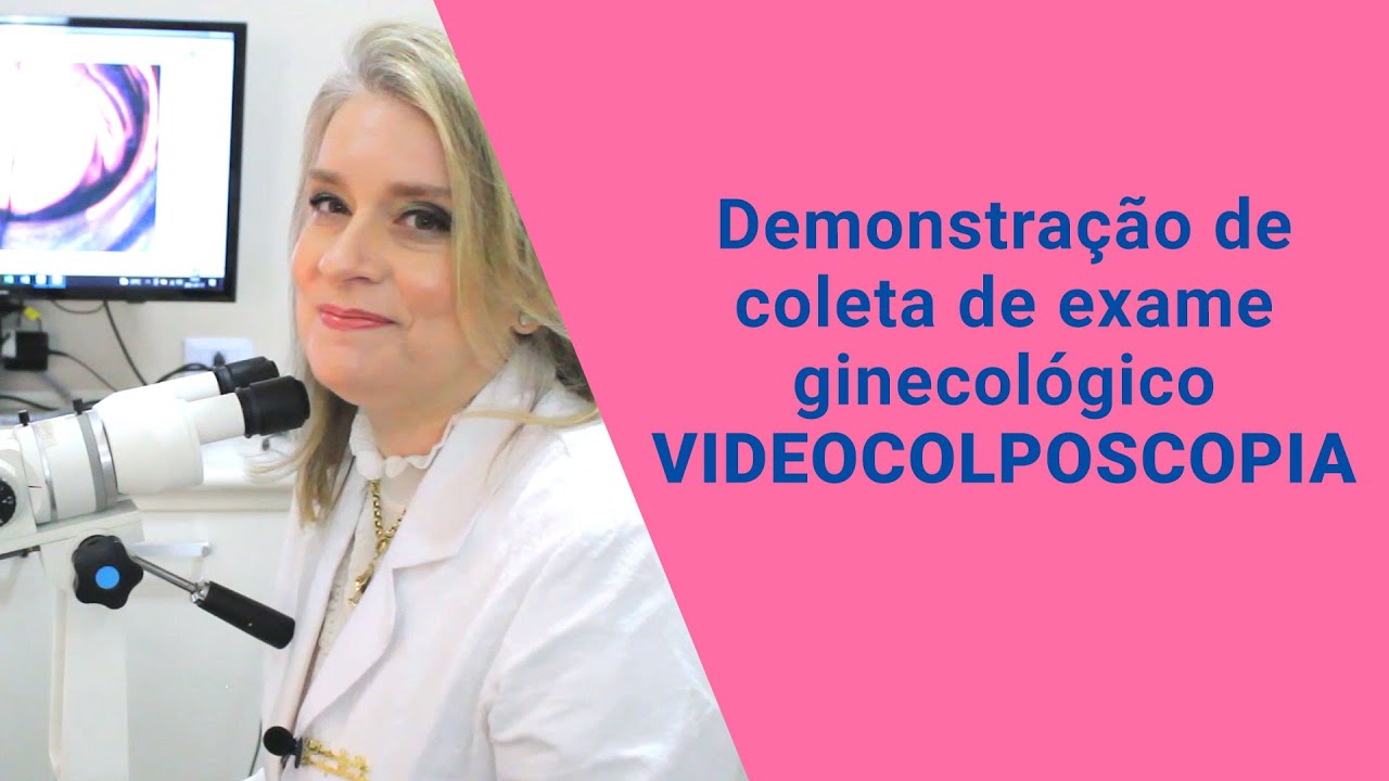 Demonstração de Coleta de Exame Ginecológico - Videocolposcopia | Dra. Christiane Curci Régis