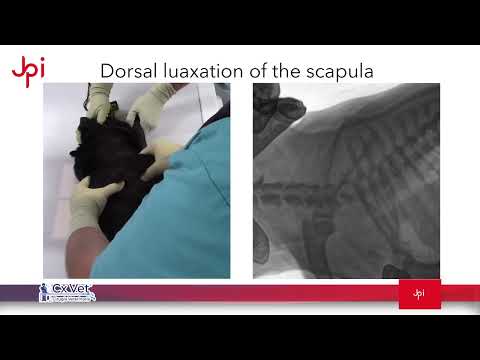 JPI DynaVue Fluoroscopy  |  Dorsal Luxation of the Scapula