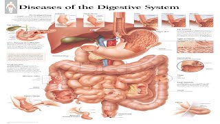 Ultimate Guide to Digestive System Diseases (2024) #ibd