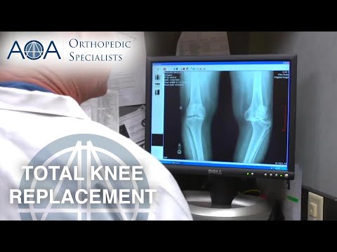 AOA Orthopedic Specialists - Dr. Mark Woolf - Total Knee Replacement