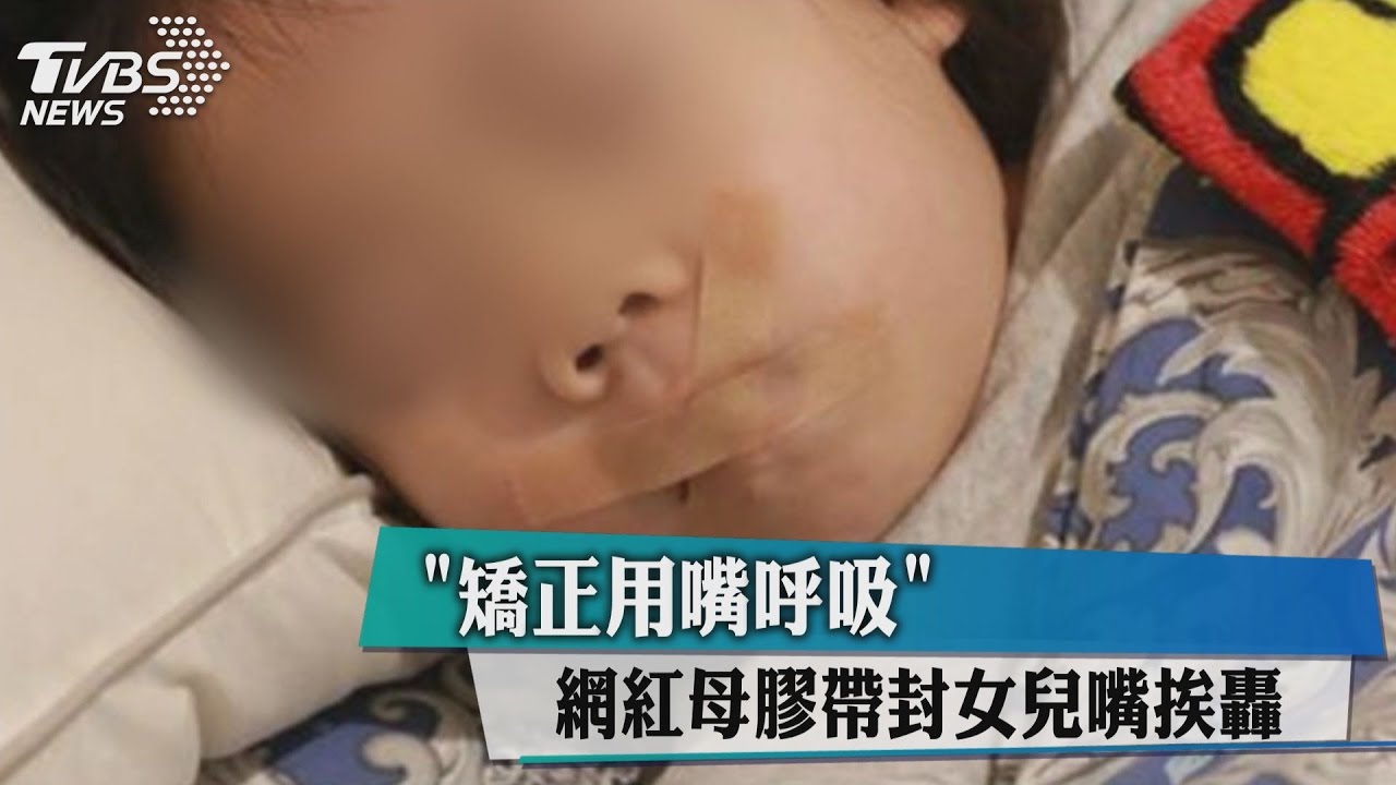 矯正用嘴呼吸　網紅母膠帶封女兒嘴挨轟