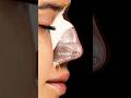 SKIN ️ Superficial Structure Covering All Elements Of The Outer Nose Kaminskyi