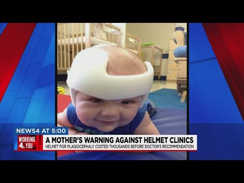 Baby helmet issues