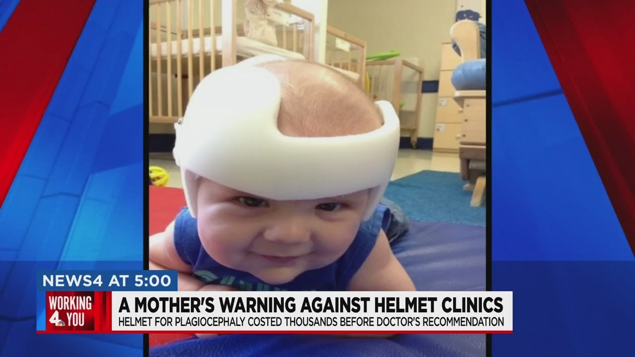 Why is plagiocephaly bad?