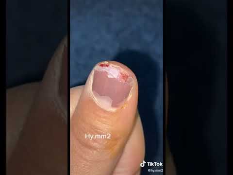 سلام عليكم وعليكم السلام