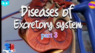 Excretory System Diseases: Understanding the Impact on our Health | Class 11 Biology #neet #biology