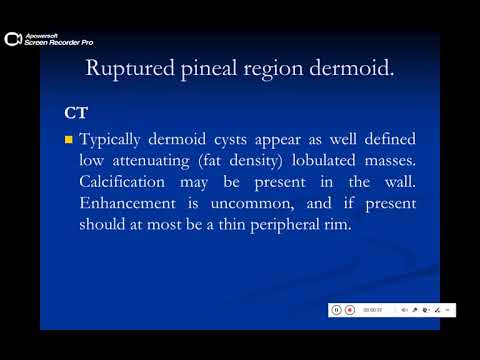 Quiz powerpoint video case 162 - Refresh your knowledge