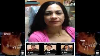 Dental Implant Specialist in Bay Area - Dr. Sambhav Jain - Patient Testimonial