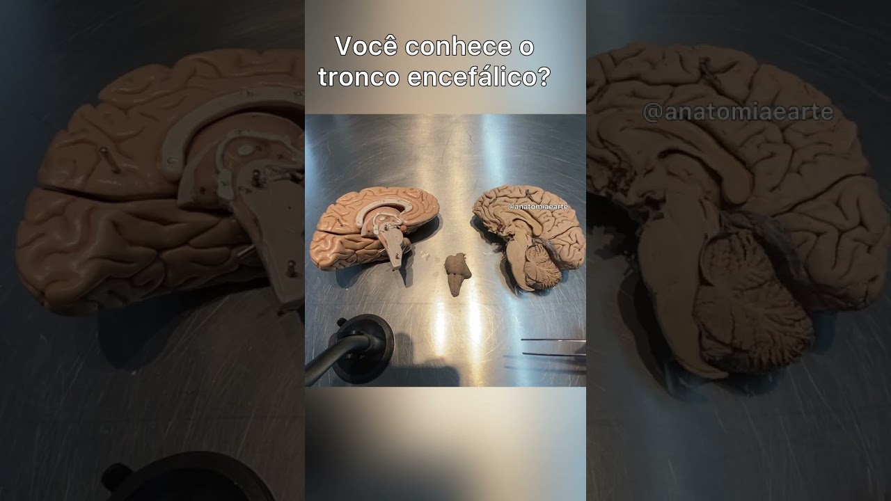 conheça o Tronco Encefálico #anatomiapratica #neuroscience #neuroanatomia