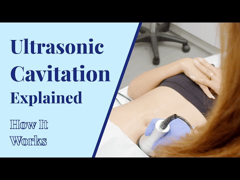 How Does Ultrasonic Cavitation Work? | Body Treatments at BYou Laser Clinic in NYC