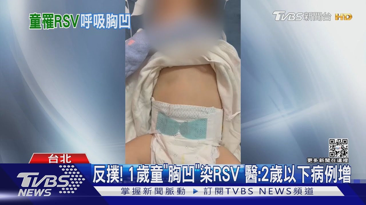 反撲!1歲童「胸凹」染RSV 醫:2歲以下病例增