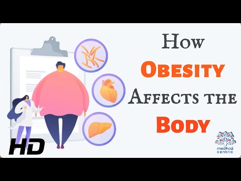 The Heavy Burden of Obesity: Understanding its Effects on Your Body