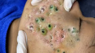 طرق حماية بشرة الوجهCC705