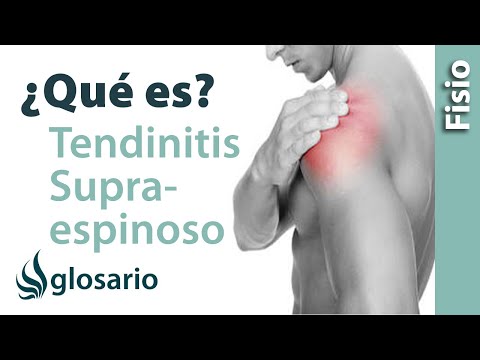 TENDINITIS DEL SUPRAESPINOSO | ¿Qué es?
