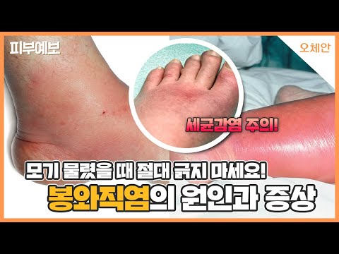 추천템