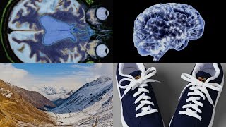 Treating Traces of Trauma, Why Your Shoes Are Untied, and More: 60 Second Scienc