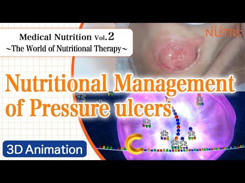 栄養学科 Medical Nutrition ~The World of Nutritional Therapy~ Vol.2 Nutritional Management of Pressure ulcers