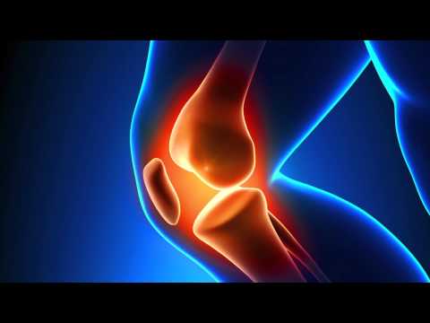 What is Posterior Cruciate Ligament Injury with Dr. Ron Short
