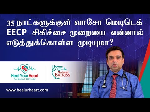 35 நாட்களுக்குள் வாசோ மெடிடெக் EECP சிகிச்சை முறையை என்னால் எடுத்துக்கொள்ள முடியுமா?