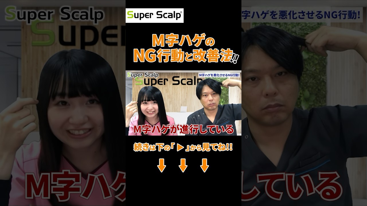 【M字ハゲ】悪化の前に「やるべきこと」と「やってはいけないこと」