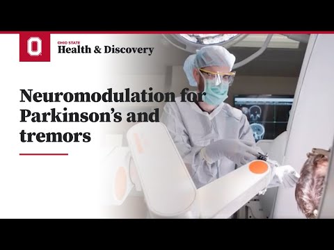 Neuromodulation for Parkinson's and tremors | Ohio State Medical Center