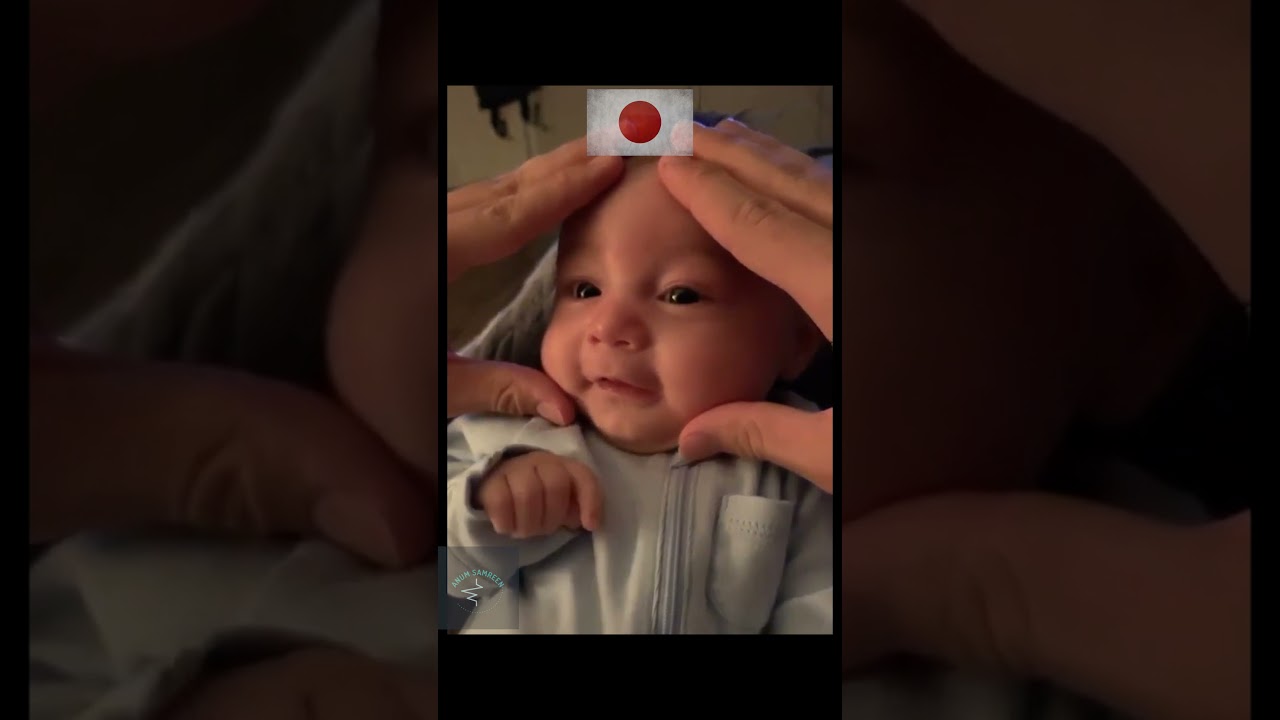 Baby Face Squeeze Russia Vs Japan